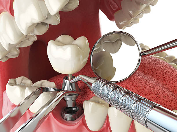 Best Emergency Treatment for Oral Infections in Solana, FL